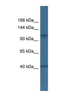 HK1 / Hexokinase 1 Antibody (aa313-362)
