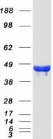 Human PHYHIPL Protein (Recombinant Myc-DDK (Flag))