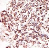 PIM2 / Pim-2 Antibody (aa277-308)