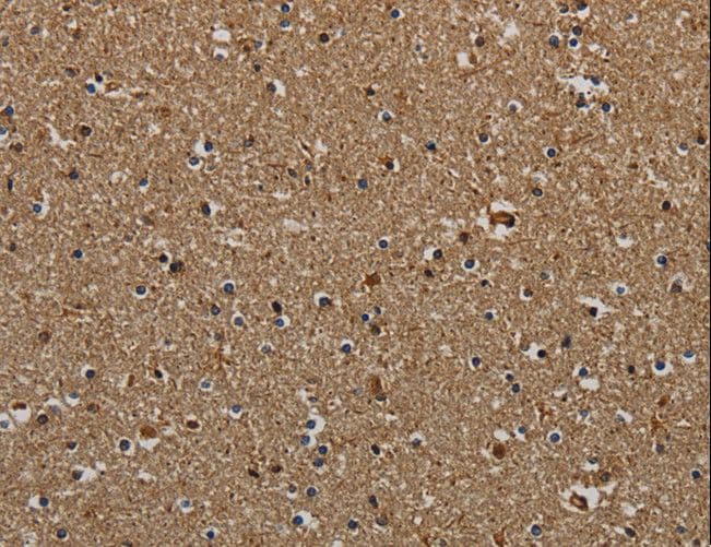 KLK6 / Kallikrein 6 Antibody