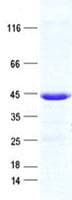Human CMT2 / MAD2L1BP Protein (Recombinant His, N-Terminal)
