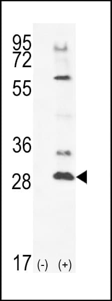 TSSK4 / TSSK5 Antibody (aa226-254)