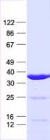 Human TSEN34 Protein (Recombinant His, N-Terminal)