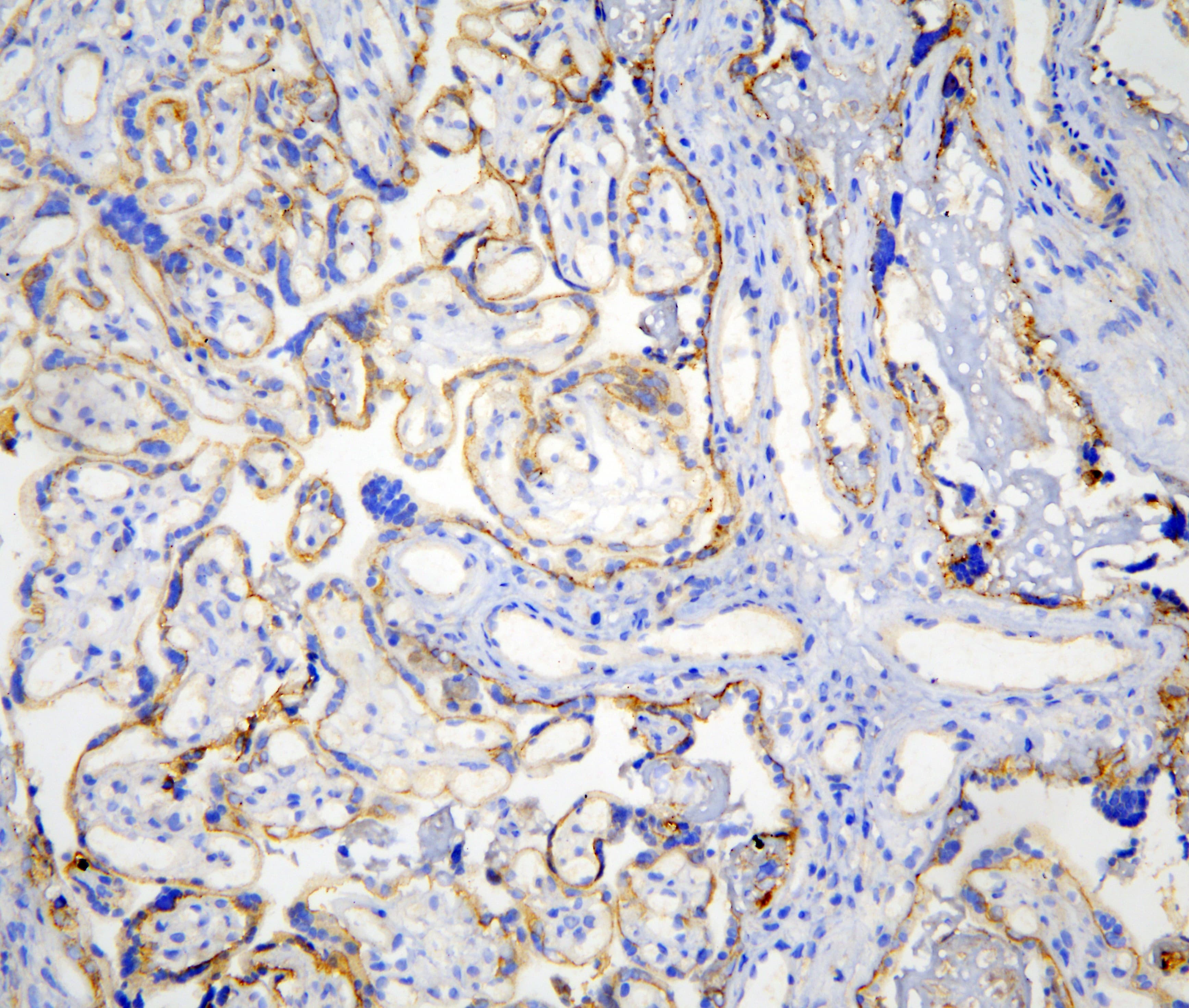 CDH3 / P-Cadherin Antibody