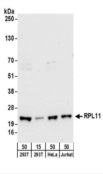 RPL11 / Ribosomal Protein L11 Antibody (aa128-178)