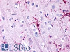 PathPlus™ GPR39 Antibody (Extracellular Domain)