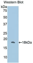 ANXA2 / Annexin A2 Antibody (aa41-182)