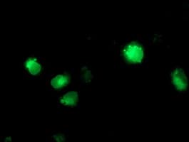 Monoclonal Mouse anti-Human CYP2C9 / Cytochrome P450 2C9 Antibody (clone OTI1D7, IHC, IF, WB)