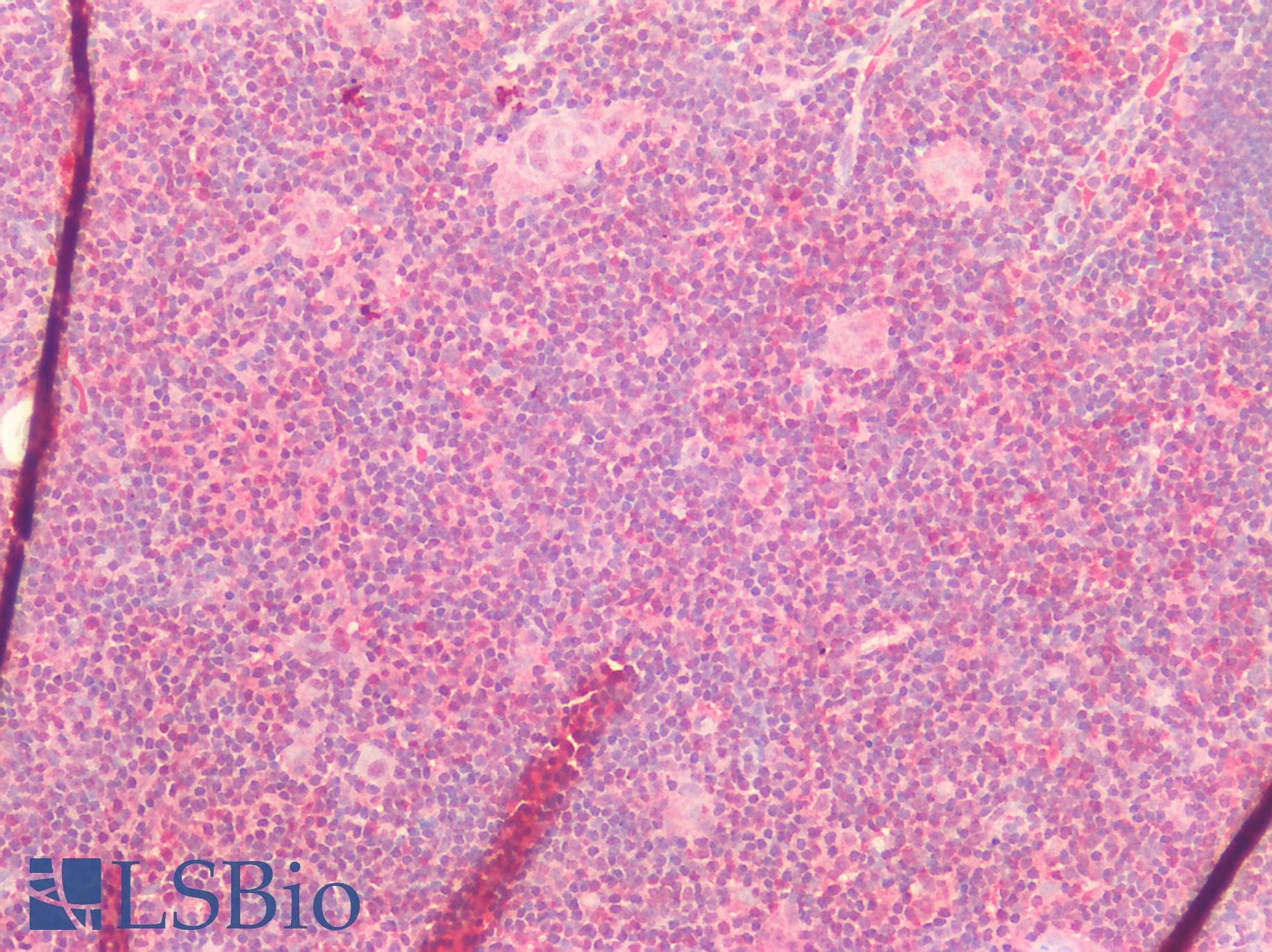 IHC-plus™ Polyclonal Rabbit anti-Human ATG16L1 / ATG16L Antibody (IHC)