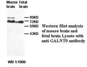 Polyclonal Rabbit anti-Human GALNT9 Antibody (IHC, WB)