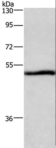 NRG1 / Heregulin / Neuregulin Antibody