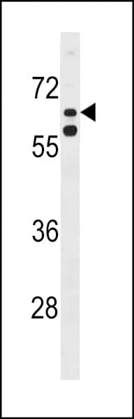 IHC-plus™ KLHL38 Antibody (aa76-104)