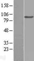Complement C2 Protein (Over-Expression Lysate Myc-DDK (Flag))