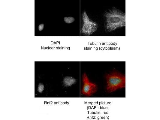 IHC-plus™ RNF2 / RING2 / RING1B Antibody (aa189-201)
