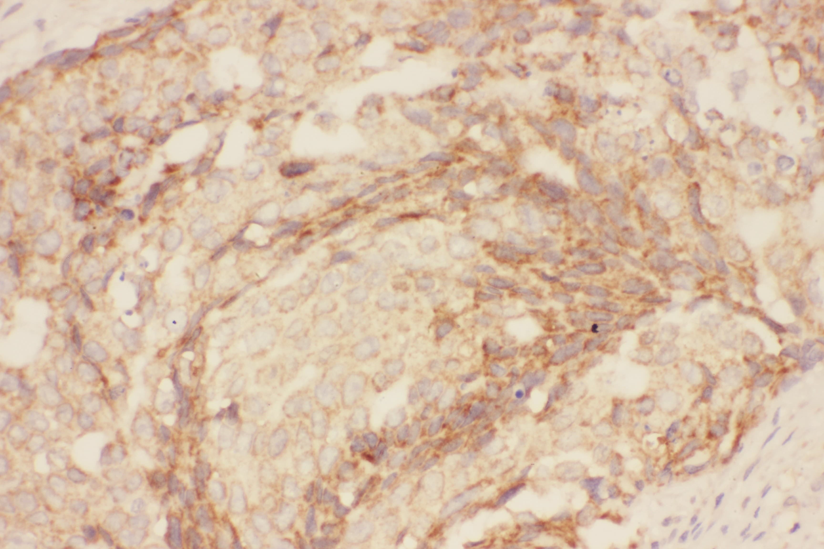CCL26 / Eotaxin 3 Antibody (aa24-94)