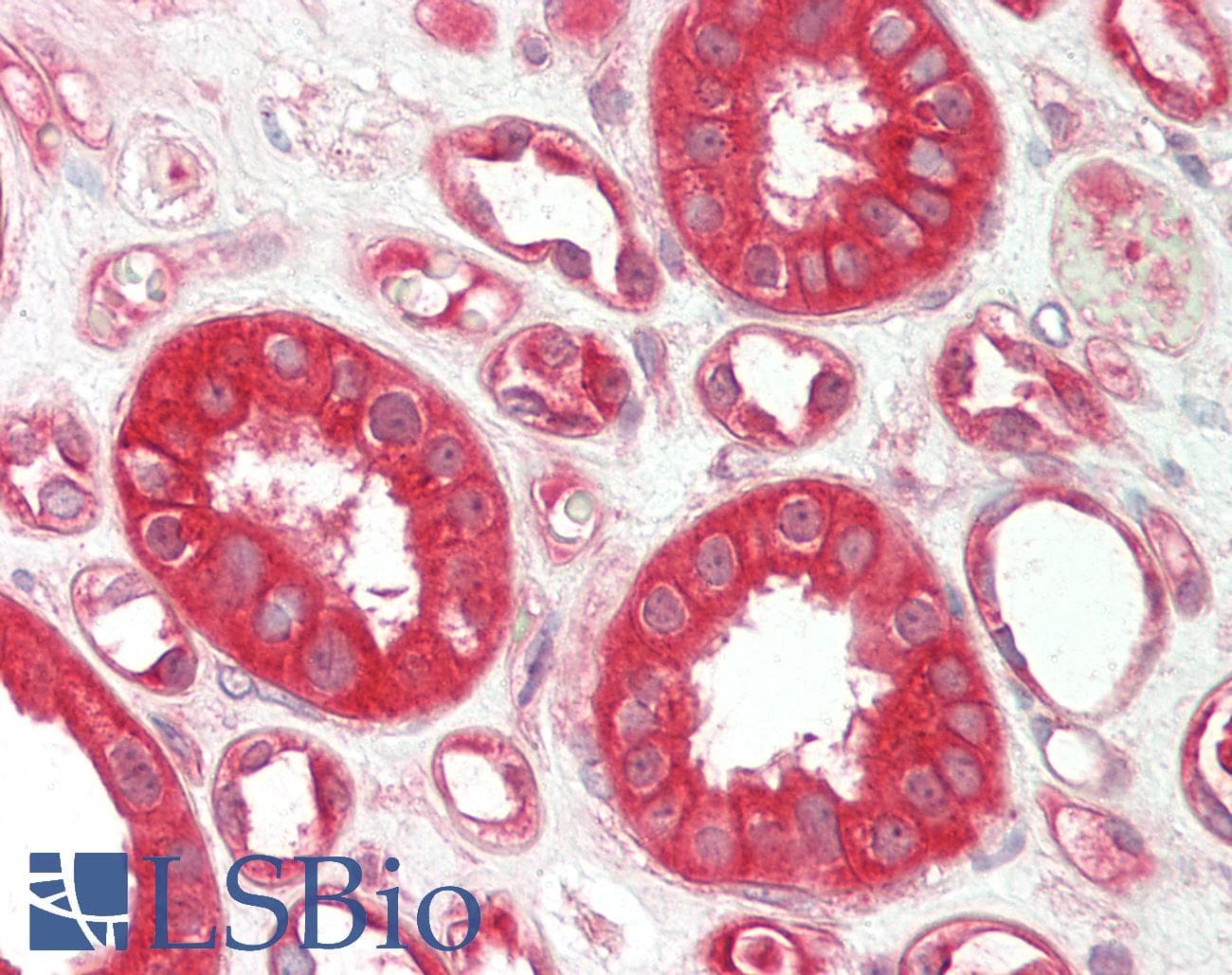 Polyclonal Rabbit anti-Human SLC6A2 / NET Antibody (aa396-445, IHC, WB)