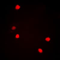 JUN / c-Jun Antibody (phospho-Ser73/100)