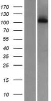 WDR63 Protein (Over-Expression Lysate Myc-DDK (Flag))