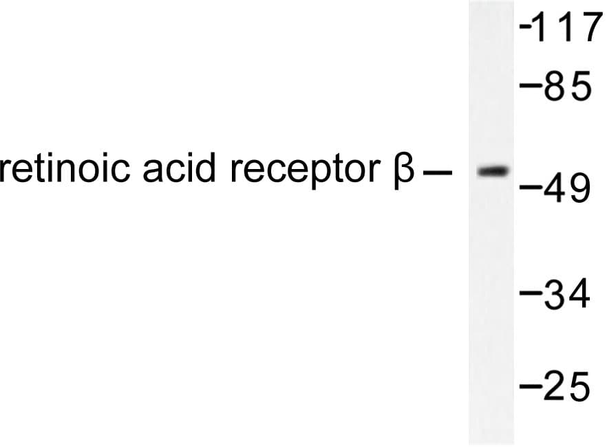 RARB / RAR Beta Antibody (Leu359)