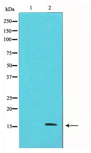 Polyclonal Rabbit anti-Human p16INK4a / CDKN2A Antibody (WB)