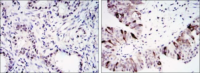 Monoclonal Mouse anti-Human CCNB1 / Cyclin B1 Antibody (clone 1B10, IHC, WB)