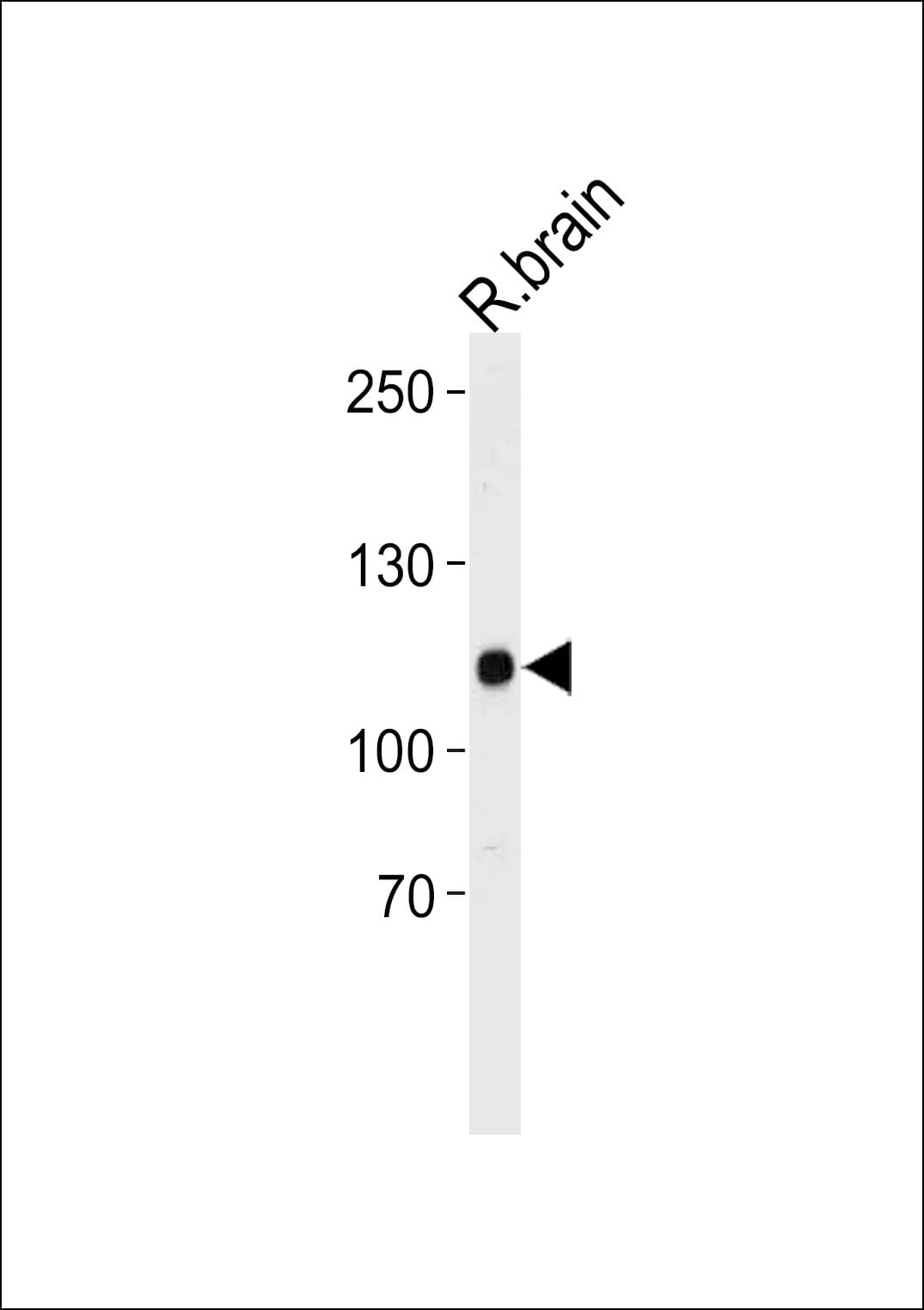 CASK Antibody (aa589-616)