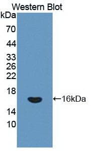 IFN Gamma / Interferon Gamma Antibody (aa24-166)