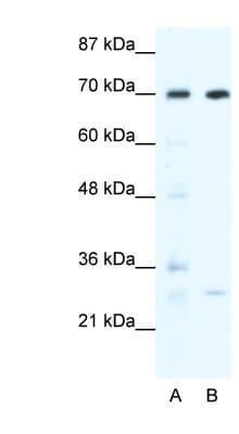 Polyclonal Rabbit anti-Human WRNIP1 / WHIP Antibody (aa67-116, IHC, WB)