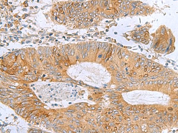 TXNDC12 Antibody