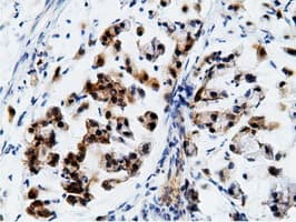 EPHX2 / Epoxide Hydrolase 2 Antibody (clone OTI1H5)