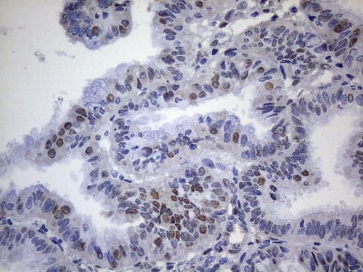 TP53BP1 / 53BP1 Antibody (aa1-300, clone OTI9C8)