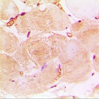 TNNI3 / Cardiac Troponin I Antibody (Internal)