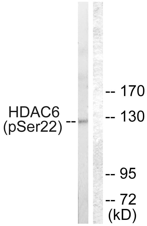 HDAC6 Antibody (phospho-Ser22)