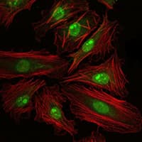 Monoclonal Mouse anti-Human CREB1 / CREB Antibody (clone 5G3, IHC, IF, WB)