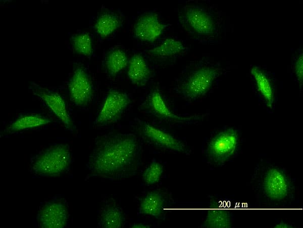 IHC-plus™ Monoclonal Mouse anti-Human GART / GARS Antibody (clone 4D6-1D5, IHC, IF, WB)
