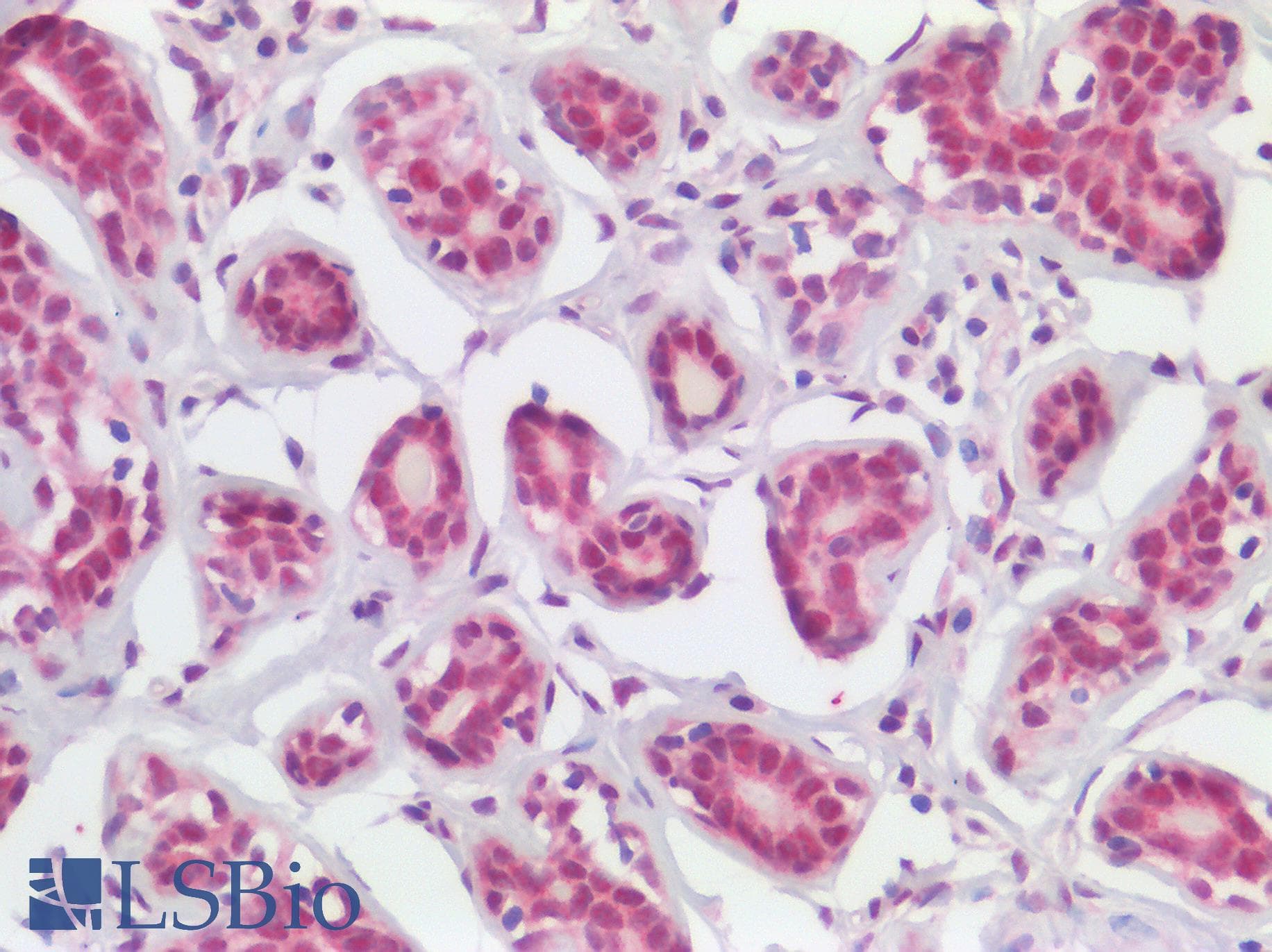 IHC-plus™ ARID1A / BAF250 Antibody