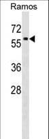 Polyclonal Rabbit anti-Human P4HA1 Antibody (aa414-442, WB)