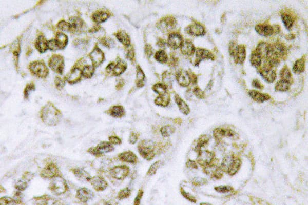 FOXO3 / FOXO3A Antibody (phospho-Ser253)