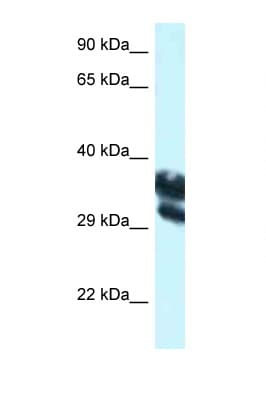 EEF1D Antibody (aa160-209)