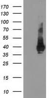 ARH / LDLRAP1 Antibody (clone OTI7G2)