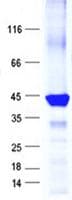Human NOLA2 Protein (Recombinant GST, N-terminus + His, C-terminus)