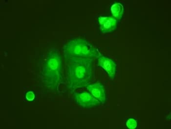 Polyclonal Rabbit anti-Human TNFAIP1 Antibody (aa27-52, IHC, WB)