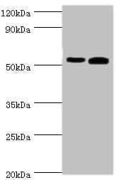 Polyclonal Rabbit anti-Human RALDH2 / ALDH1A2 Antibody (aa1-180, WB)