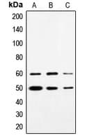 SS18 Antibody (N-Terminus)