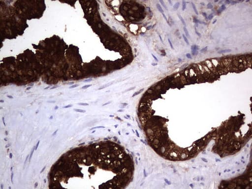MSMB / MSP Antibody (clone UMAB148)