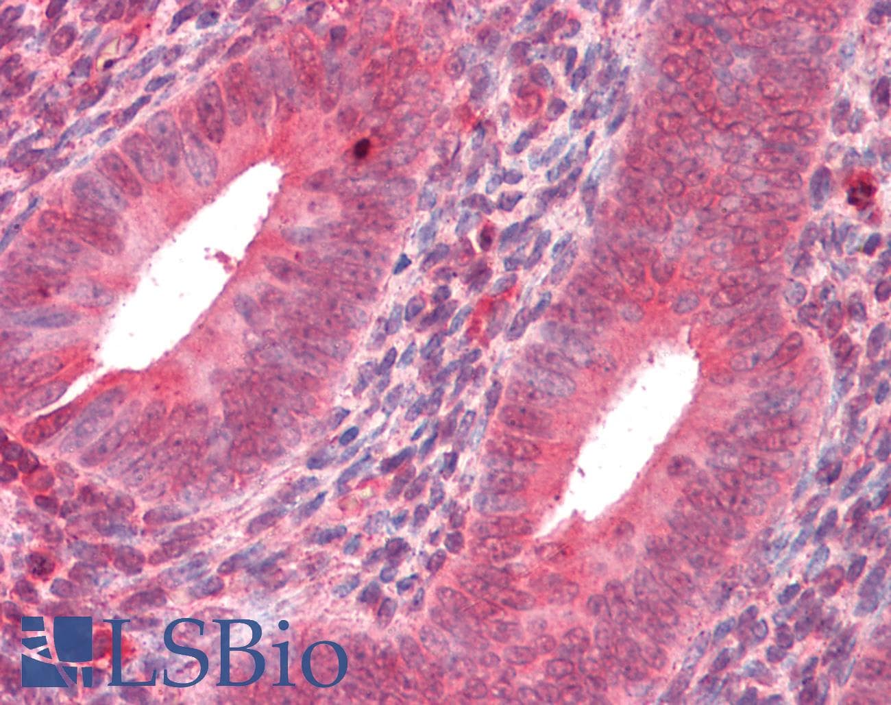 IHC-plus™ MMP14 Antibody