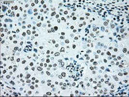 BRAF / B-Raf Antibody (clone OTI4C5)