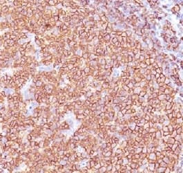 CD20 Antibody (clone SPM618)