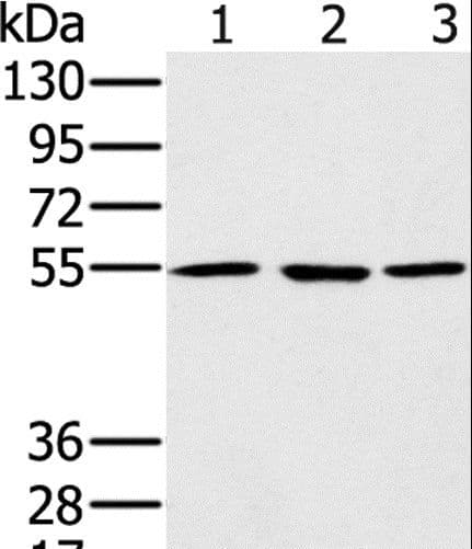 Polyclonal Rabbit anti-Human PSMC1 Antibody (IHC, WB)