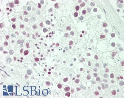 IHC-plus™ RANBP3 Antibody (aa150-200)